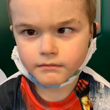Dětský pacient před brýlovou korekcí