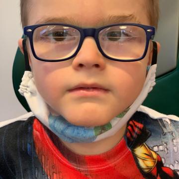 Dětský pacient s brýlovou korekcí
