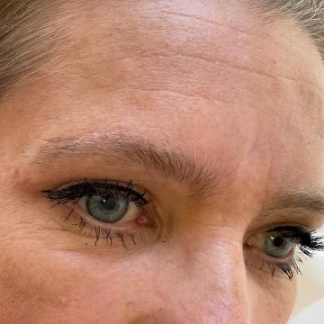 Pacientka před úpravou obočí japonskou metodou microblading