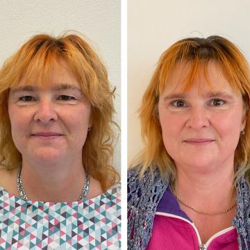 Srovnávací fotky pacientky před a po operaci převislých očních víček