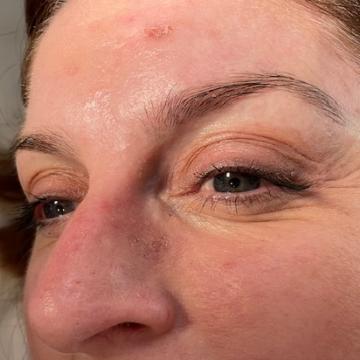 Pacientka před úpravou obočí japonskou metodou microblading