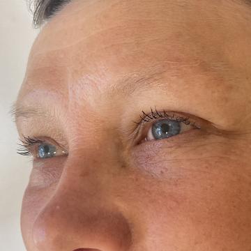 Pacientka před úpravou obočí japonskou metodou microblading