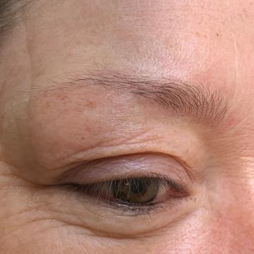 Detail obočí před úpravou metodou microblading