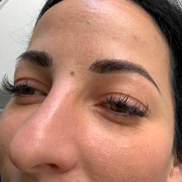 Pacientka po úpravě obočí japonskou metodou microblading