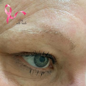 Detail obočí před úpravou metodou microblading u pacientky po léčbě rakoviny chemoterapií