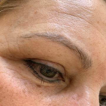 Pacientka před úpravou obočí japonskou metodou microblading