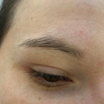 Pacientka před úpravou obočí japonskou metodou microblading