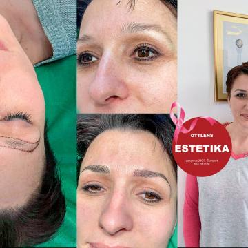 Onkologická pacientka se specialistkou na Microblading