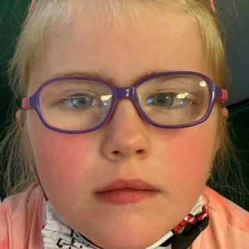Dětská pacientka s brýlovou korekcí