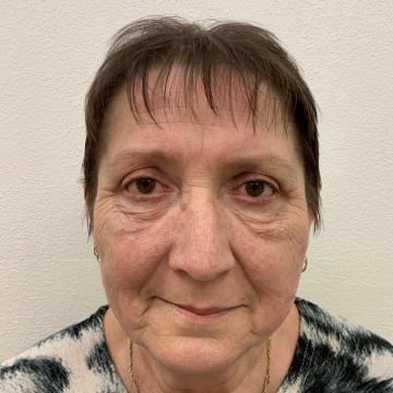 Pacientka po operaci převislých horních očních víček