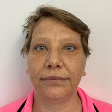 Pacientka po operaci převislých horních a dolních očních víček