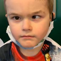 Dětský pacient před brýlovou korekcí